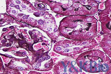 新疆六胺银染色