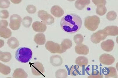 新疆瑞氏吉姆萨染色