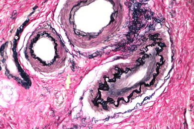 新疆弹力纤维染色