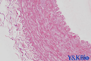 新疆茜素红染色