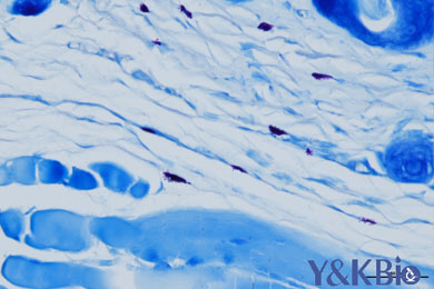 新疆甲苯胺蓝染色