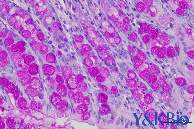 新疆糖原PAS染色