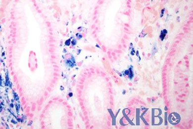 新疆普鲁士蓝染色