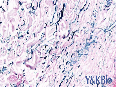 新疆维多利亚蓝染色