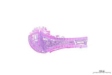 新疆脱钙（慢脱）