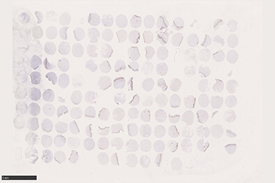 新疆组织芯片切片