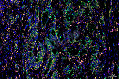 新疆普通切片免疫荧光三标（四色）染色