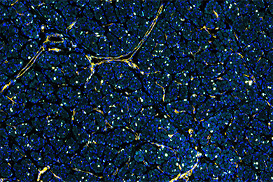 新疆普通切片免疫荧光五标（六色）染色