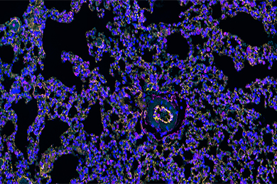 新疆组织芯片免疫荧光双标（三色）染色