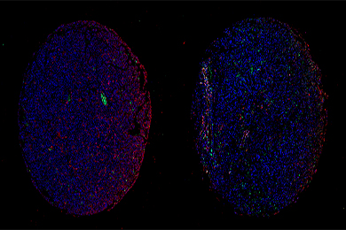 新疆组织芯片（荧光单标 双色）扫描