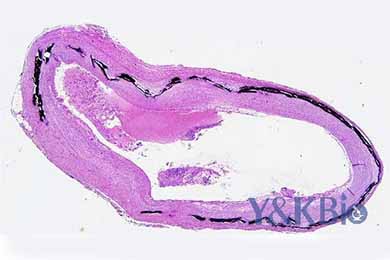 新疆Von Kossa染色