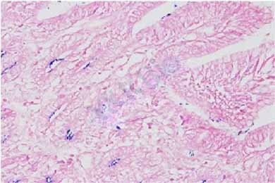 新疆革兰氏染色