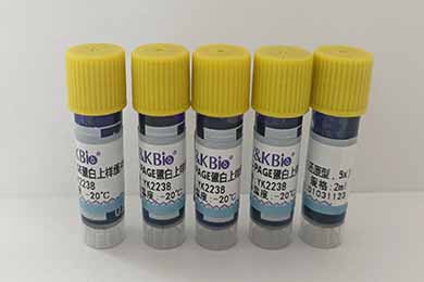 新疆SDS-PAGE蛋白上样缓冲液（还原型，5x）