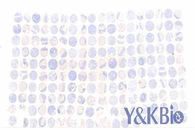 新疆白光芯片扫描