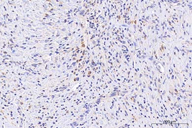 新疆Anti-iNOS Antibody