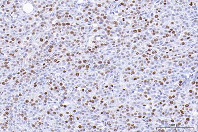 新疆Anti-Ki67 Antibody [SR00-02]