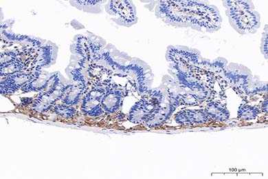 新疆Anti-MMP-2 Antibody [PSH11-26]